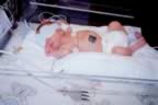 nicu7.jpg (62kb)